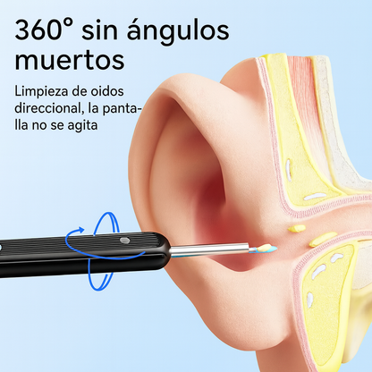 Otoscopio NE3™ – Mira y limpia tus oídos en HD
