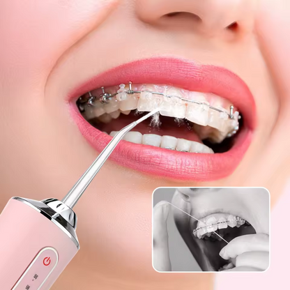 Irrigador Bucal Eléctrico - ¡La limpieza y frescura que tu sonrisa merece!